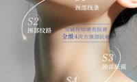 SKINIST 4S 颈龄精雕｜养出天鹅颈